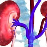kidney-600x357-1.jpg